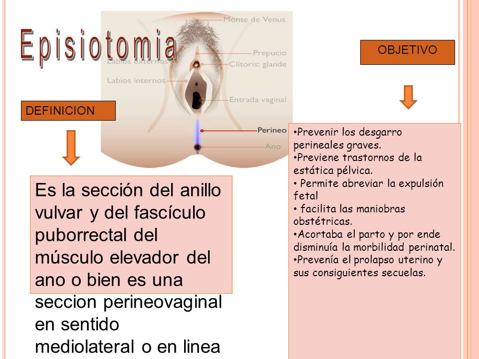 concepto de episiotomia y episiorrafia